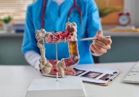 Cancer colorectal : un test simple face à un tabou persistant