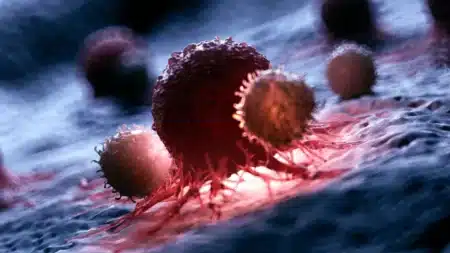 On pensait ce cancer imbattable, ce nouveau traitement vient tout bouleverser