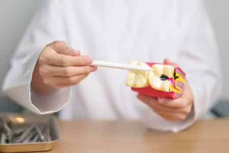 Des caries dentaires soignées par les Néandertaliens il y a 59 000 ans